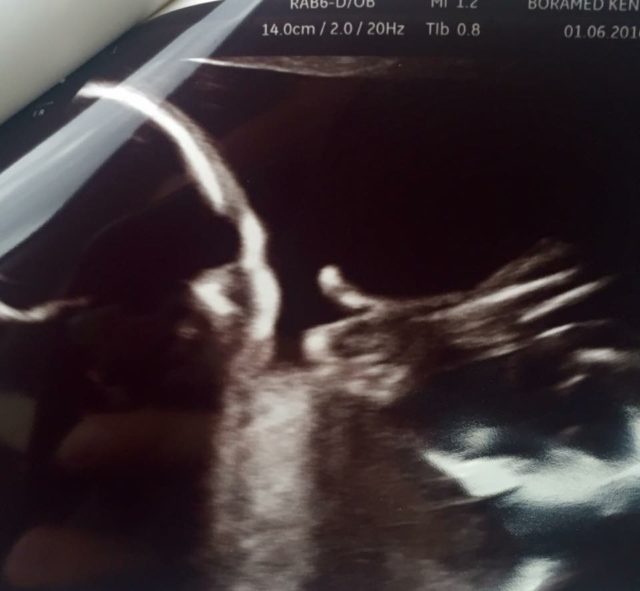 ciąża, dziecko, macierzyństwo, USG